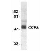 Anti-CCR8 antibody used in Western Blot (WB). GTX74370