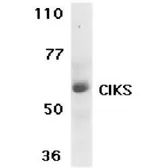 Anti-CIKS antibody used in Western Blot (WB). GTX74408
