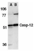 Anti-Caspase 12 antibody, N-term used in Western Blot (WB). GTX74429