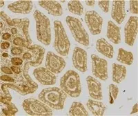 Anti-DC-SIGN antibody used in IHC (Frozen sections) (IHC-Fr). GTX74430