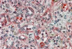Anti-TXNDC1 antibody, C-term used in IHC (Paraffin sections) (IHC-P). GTX74441