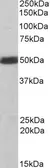 Anti-CSK antibody used in Western Blot (WB). GTX74502
