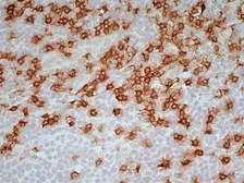 Anti-CD8 antibody [LT8] used in IHC (Frozen sections) (IHC-Fr). GTX74773