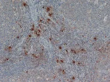 Anti-Mast cell tryptase antibody [AA1] used in IHC (Paraffin sections) (IHC-P). GTX75011