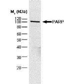 Anti-PARP antibody [A6.4.12] used in Western Blot (WB). GTX75098