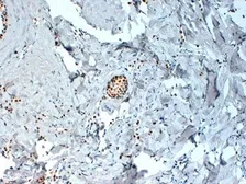 Anti-Estrogen Receptor alpha antibody [6F11] used in IHC (Paraffin sections) (IHC-P). GTX75362