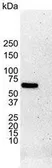 Anti-Estrogen Receptor alpha antibody [6F11] used in Western Blot (WB). GTX75362