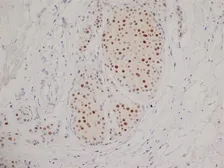 Anti-Progesterone Receptor antibody [1A6] used in IHC (Paraffin sections) (IHC-P). GTX75363