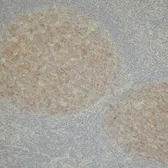 Anti-CD10 antibody [56C6] used in IHC (Paraffin sections) (IHC-P). GTX75376