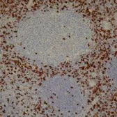 Anti-CD8 antibody [4B11] used in IHC (Paraffin sections) (IHC-P). GTX75393