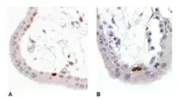 Anti-p53 (phospho Ser392) antibody [FP3.2(FPS392)] used in IHC (Paraffin sections) (IHC-P). GTX75422