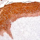 Anti-pan Cytokeratin antibody [AE1/AE3] used in Immunohistochemistry (IHC). GTX75521