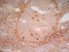 Anti-LRP1 antibody [A2Mr alpha-2] used in IHC (Frozen sections) (IHC-Fr). GTX75655