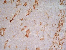 Anti-LRP1 antibody [A2Mr alpha-2] used in IHC (Frozen sections) (IHC-Fr). GTX75658