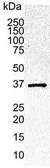 Anti-CDK6 antibody [DCS 83.1] used in Western Blot (WB). GTX75692