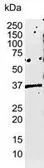 Anti-HLA-E antibody [MEM-E/02] used in Western Blot (WB). GTX75948