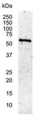 Anti-c-Myc antibody [9E10] used in Western Blot (WB). GTX75953
