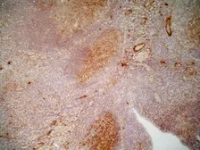 Anti-CD36 antibody [SMØ] used in IHC (Frozen sections) (IHC-Fr). GTX76435