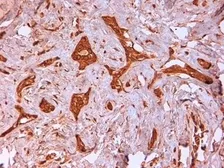 Anti-Cytokeratin 14 antibody [LL002] used in IHC (Paraffin sections) (IHC-P). GTX76603