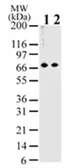 Anti-MBD1 antibody [100B272.1] used in Western Blot (WB). GTX76673