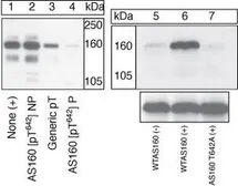 Anti-AS160 / TBC1D4 (phospho Thr642) antibody used in Western Blot (WB). GTX76675