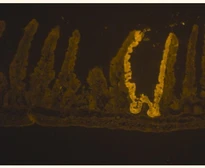 Anti-beta Galactosidase antibody used in Immunohistochemistry (IHC). GTX77365