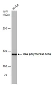 Anti-DNA polymerase delta antibody [6196] used in Western Blot (WB). GTX77606