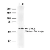 Anti-Chk2 antibody used in Western Blot (WB). GTX77609