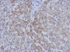 Anti-ATM antibody [2C1] (supernatant) used in IHC (Paraffin sections) (IHC-P). GTX77613