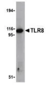 Anti-TLR8 antibody used in Western Blot (WB). GTX77620
