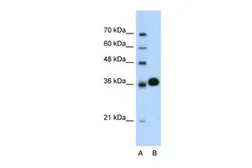 Anti-CDK6 antibody, C-term used in Western Blot (WB). GTX77661