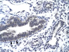 Anti-Cyclin H antibody, C-term used in IHC (Paraffin sections) (IHC-P). GTX77667