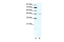 Anti-CHRND antibody, N-term used in Western Blot (WB). GTX77687
