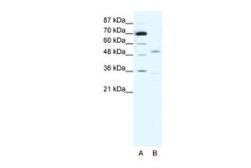 Anti-AChR gamma antibody, N-term used in Western Blot (WB). GTX77689