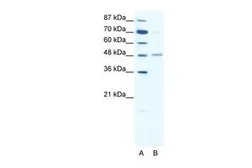 Anti-GABA A Receptor alpha 2 antibody, Internal used in Western Blot (WB). GTX77690