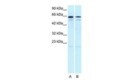 Anti-5-HT2C receptor antibody, N-term used in Western Blot (WB). GTX77700