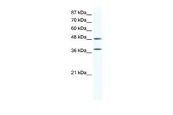 Anti-p38 MAPK antibody, C-term used in Western Blot (WB). GTX77721