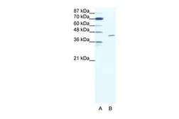 Anti-TAL1 antibody, C-term used in Western Blot (WB). GTX77745