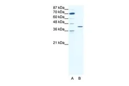 Anti-c-Fos antibody, C-term used in Western Blot (WB). GTX77747