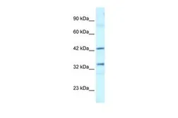 Anti-TAFI48 antibody, C-term used in Western Blot (WB). GTX77768