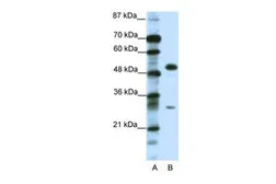 Anti-GCM1 antibody, C-term used in Western Blot (WB). GTX77775