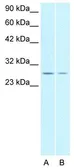 Anti-ZNF174 antibody, N-term used in Western Blot (WB). GTX77782