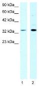 Anti-CSDA antibody, N-term used in Western Blot (WB). GTX77783