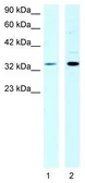 Anti-CSDA antibody, N-term used in Western Blot (WB). GTX77783