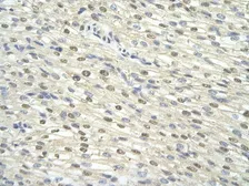 Anti-TFIIH p34 antibody, N-term used in IHC (Paraffin sections) (IHC-P). GTX77809