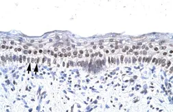 Anti-ZNF500 antibody, Internal used in IHC (Paraffin sections) (IHC-P). GTX77814