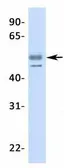 Anti-LBP9 antibody, N-term used in Western Blot (WB). GTX77815