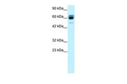 Anti-RNF12 antibody, C-term used in Western Blot (WB). GTX77821