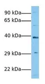 Anti-SCD antibody, Internal used in Western Blot (WB). GTX77829