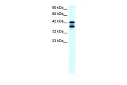 Anti-ACAT2 antibody, Internal used in Western Blot (WB). GTX77830